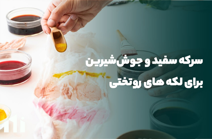 سرکه سفید و جوش‌شیرین برای از بین بردن لکه روتختی